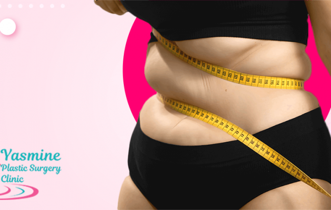 تكلفة-عملية-شفط-الدهون